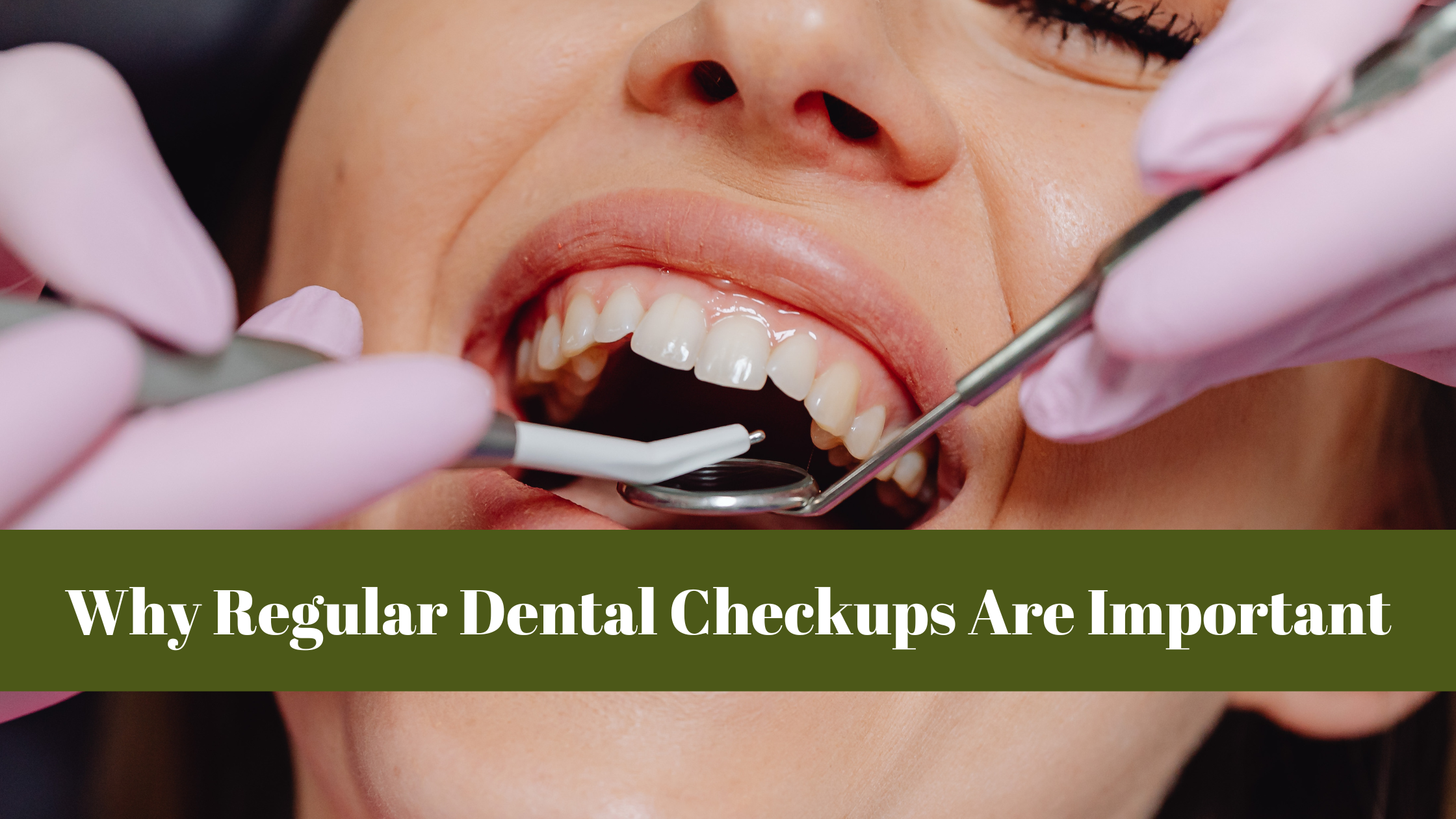 Why Regular Dental Checkups Are Important